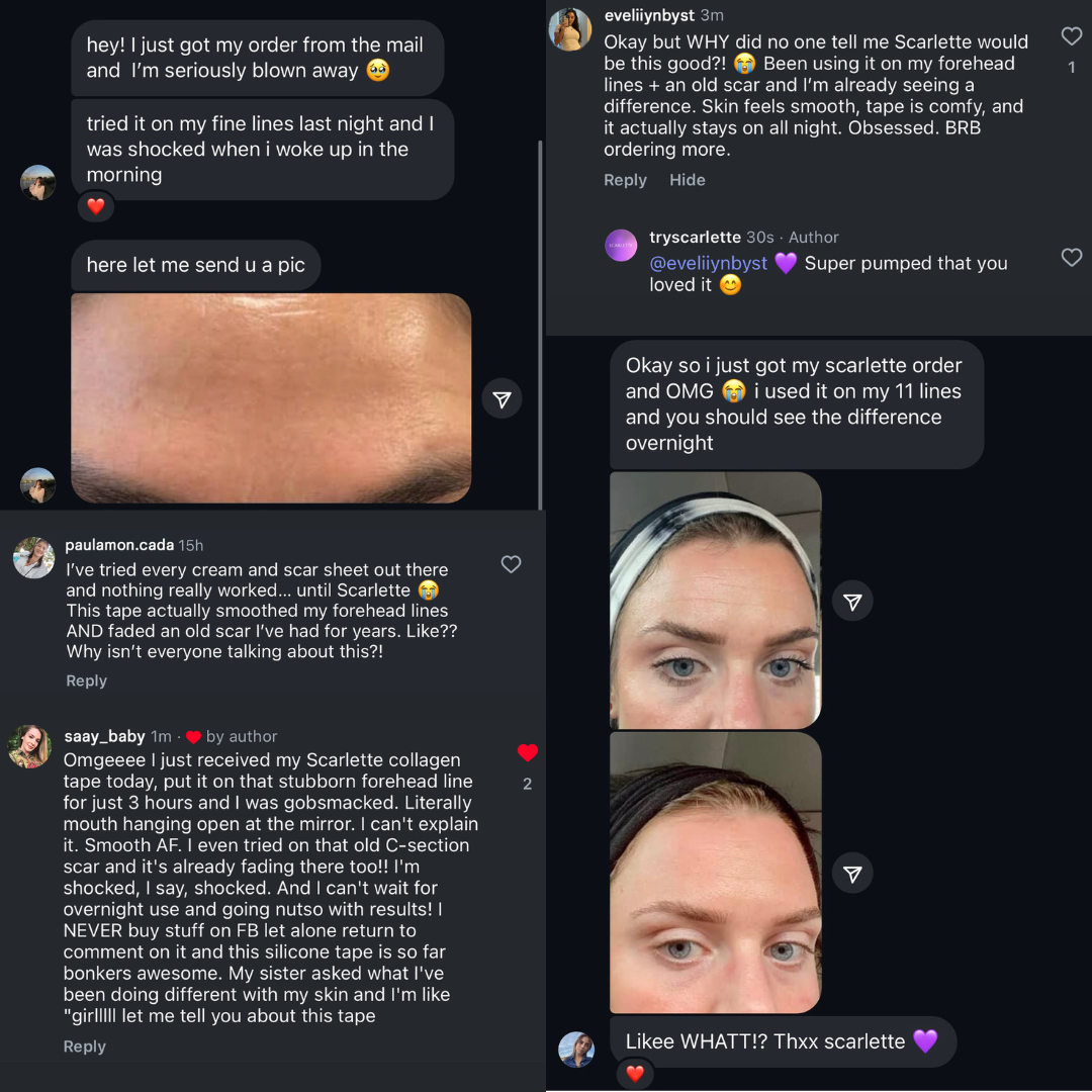 Scarlette™ Collagen Tape