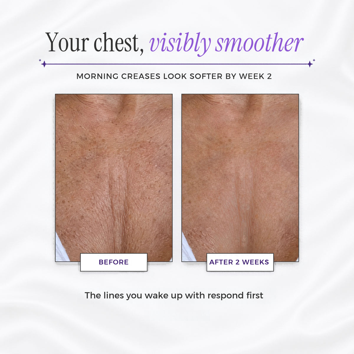 Collagen Chest Wrinkle Patch